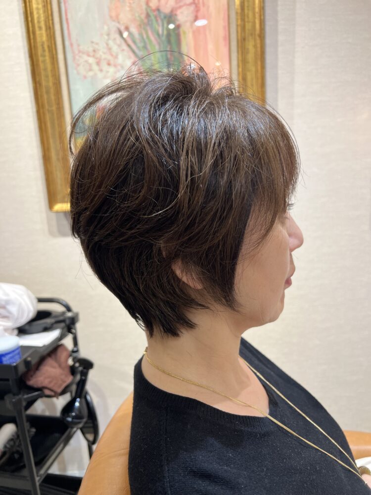 つむじが割れてしまってお悩みの方へ
